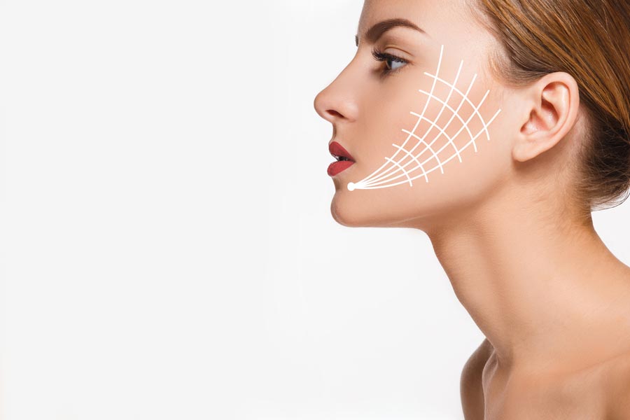 Thread Lift - Non Surgical Face Lift Treatment